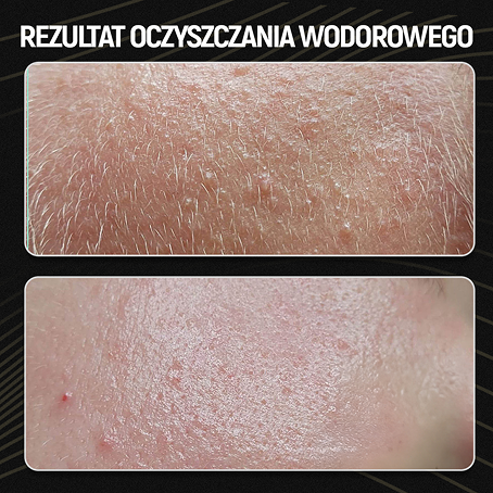 Rezultat oczyszczanie wodorowe 08_2025 V1