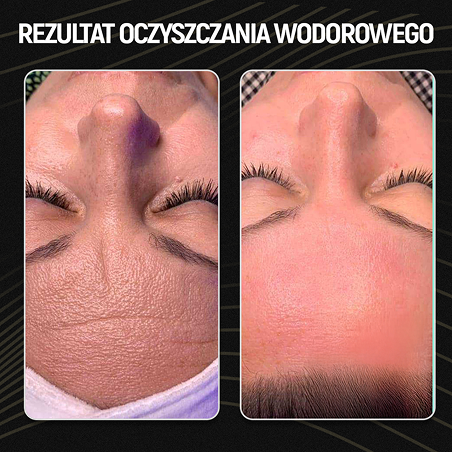 Rezultat oczyszczanie wodorowe 08_2025 V2